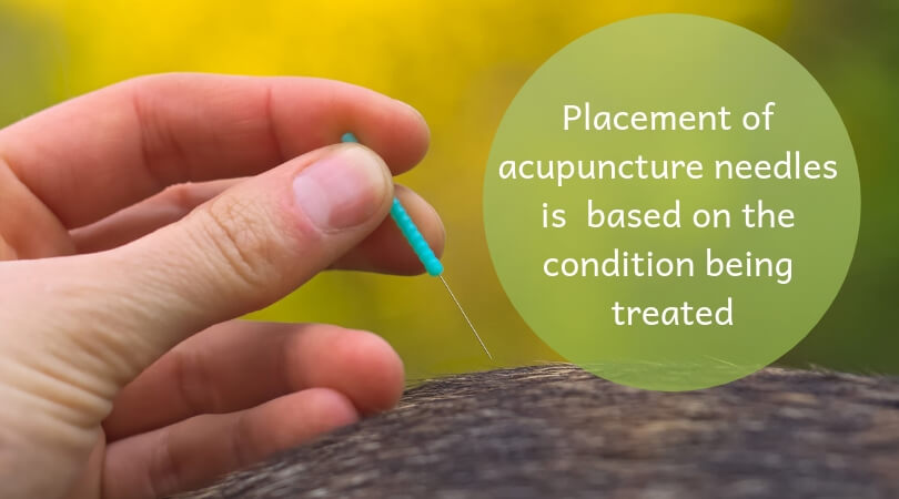 dog-acupuncture